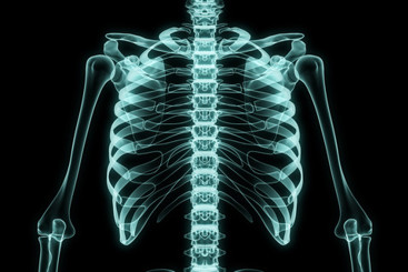 Grafikk - Røngtenbilde av overkropp hentet fra colourbox.com