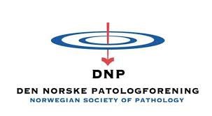 DNP logo, pil gjennom to sirkler.