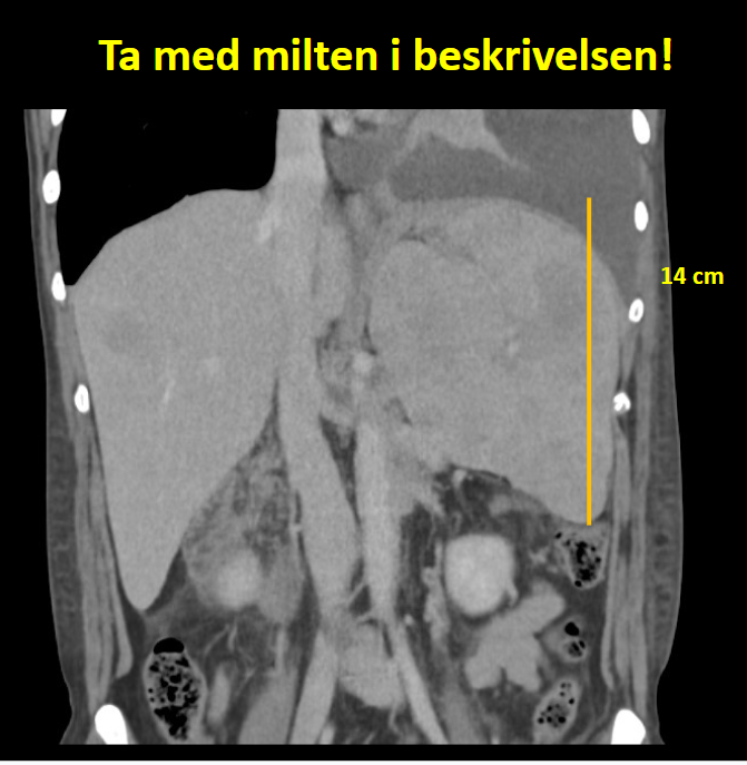 bilde av et ct bilder