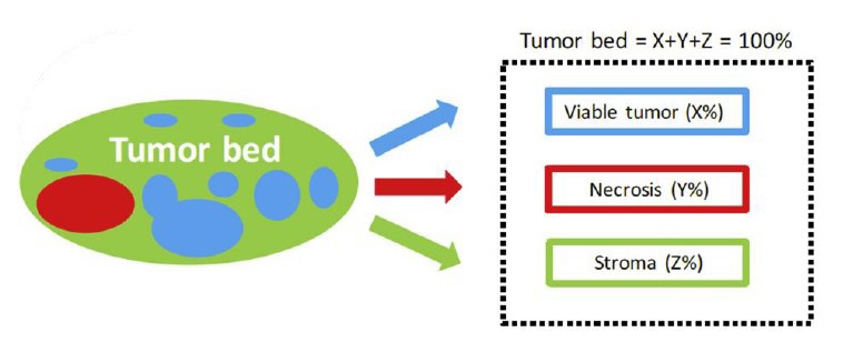 Fra Travis et al (3). Skjematisk figur av tumorsengen, med viabelt tumorvev, stroma (inflammasjon + fibrose) og nekroser