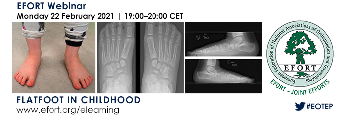 illustrasjon til webinar om plattfot for barn av EFORT