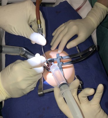 Nærbilde av operasjon på ryggsimulator