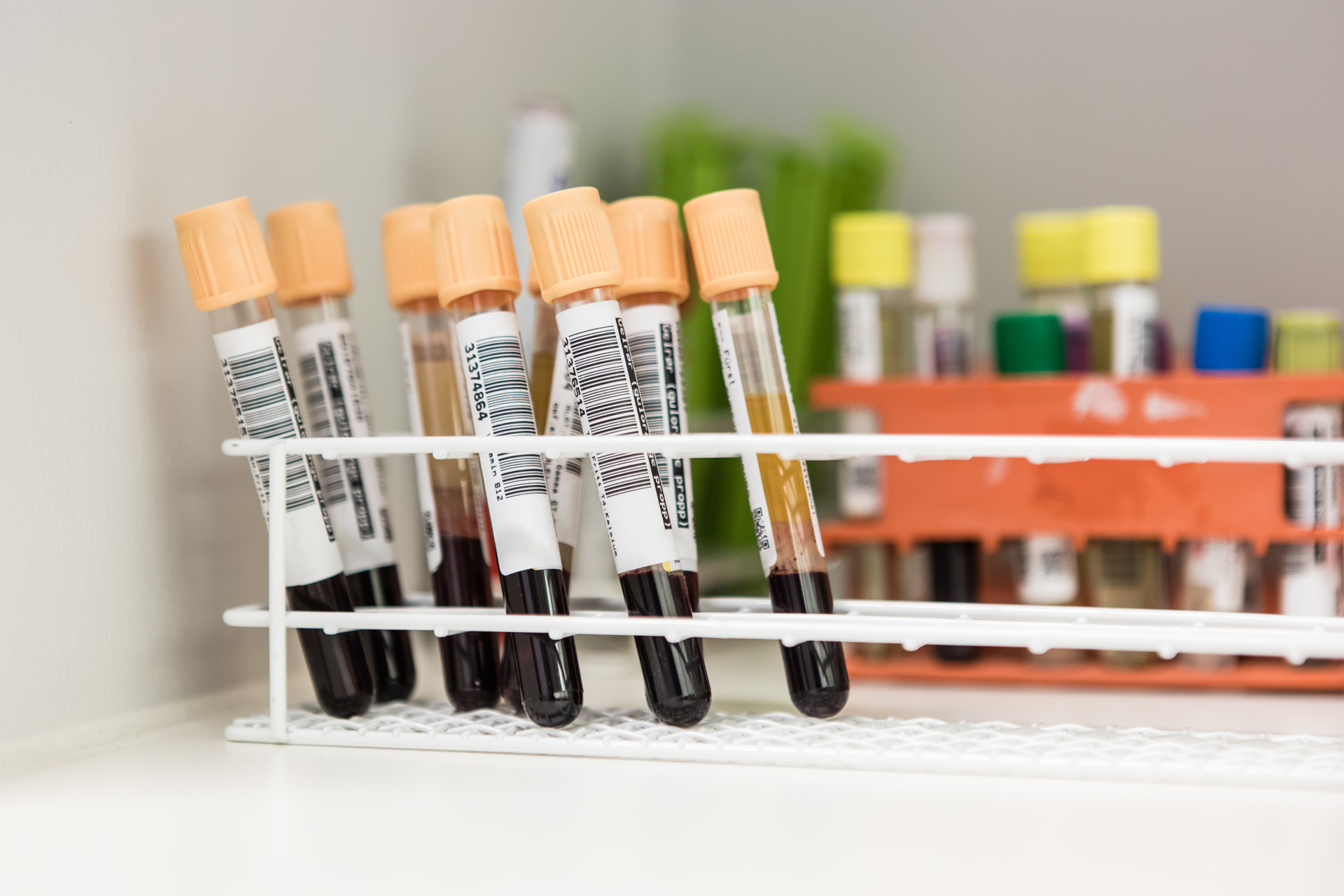 Blodprøveglass i stativ
