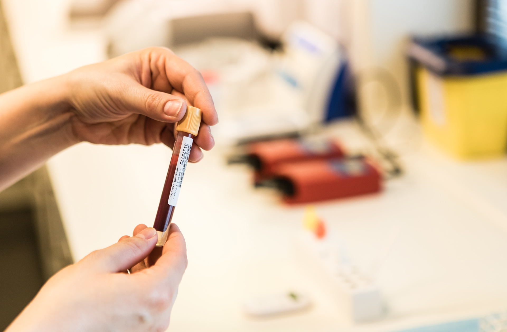 Hånd som holder blodprøve