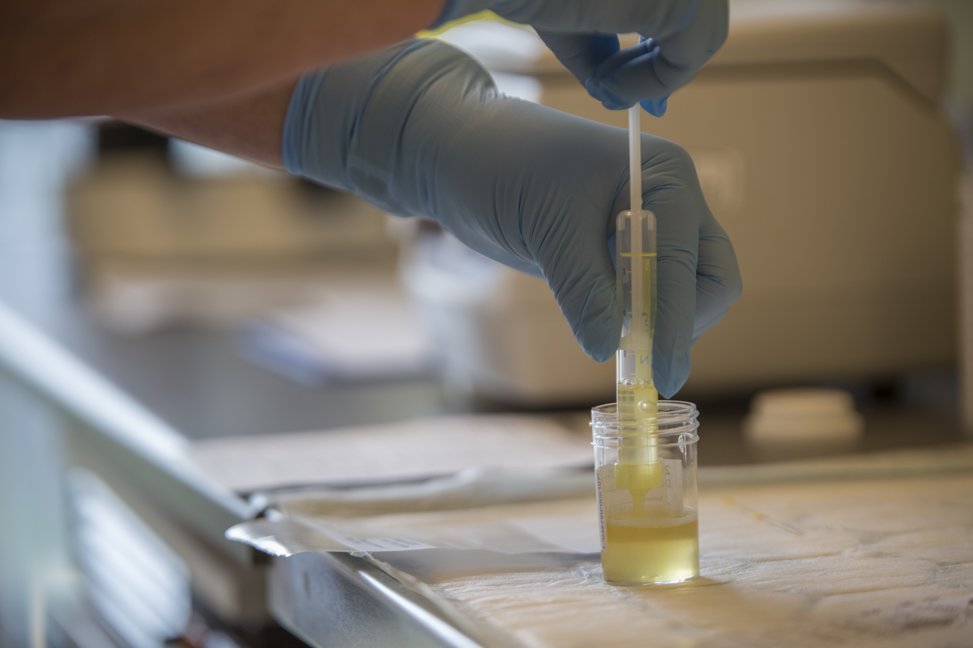 Hanskekledde hender som håndterer urinprøve